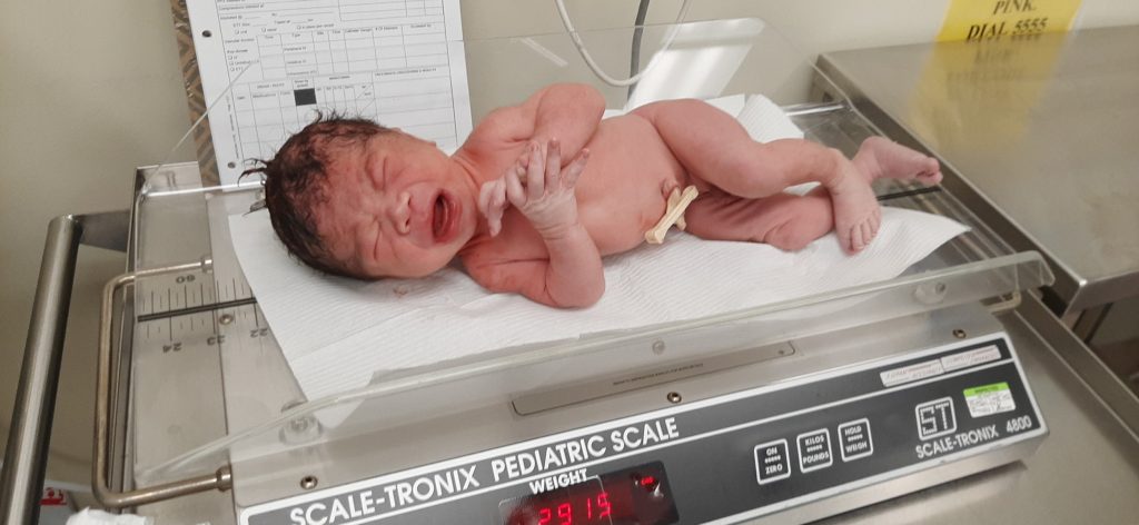 Giddy on the scale right after birth